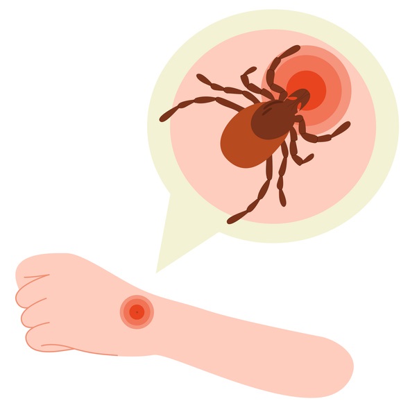 bite and tick