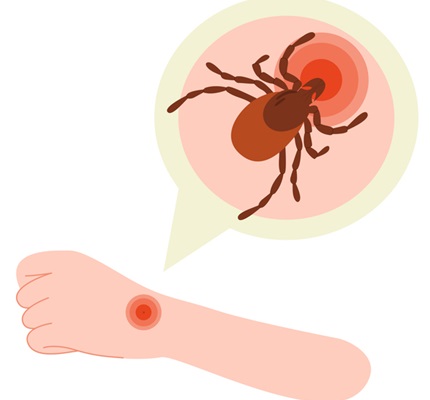 Small But Bitey: Ticks pose a risk to those working outside
