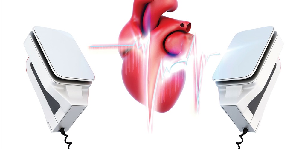 Drawing of a heart, with an overlay of a heart rhythm, and a defibrillator paddle on each side