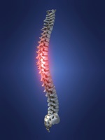 Pain in the Back