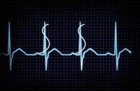 Checking Your Financial Pulse, Part 2